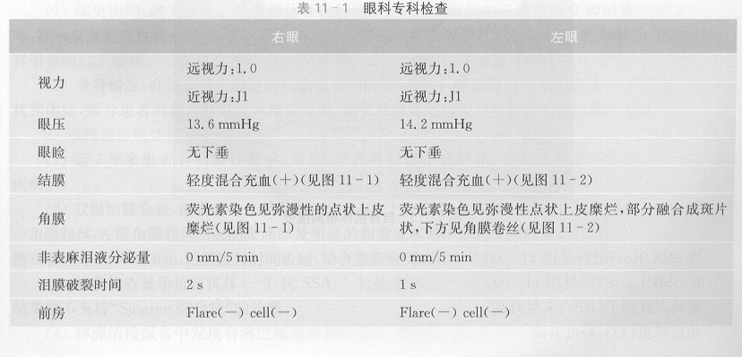 ZY016_51_1.gif